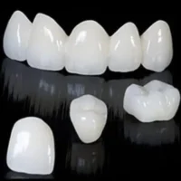 Dental Crowns in albania